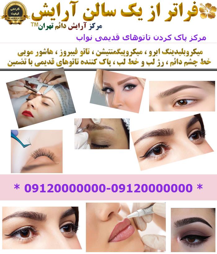 مرکز پاک کردن تاتوهای قدیمی نواب