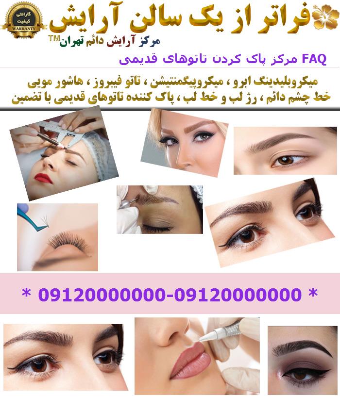 مرکز پاک کردن تاتوهای قدیمی FAQ