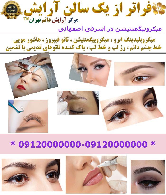 میکروپیگمنتیشن در اشرفی اصفهانی