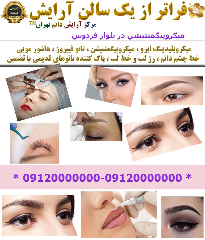 میکروپیگمنتیشن در بلوار فردوس