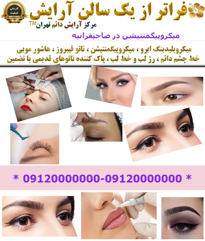 میکروپیگمنتیشن در صاحبقرانیه