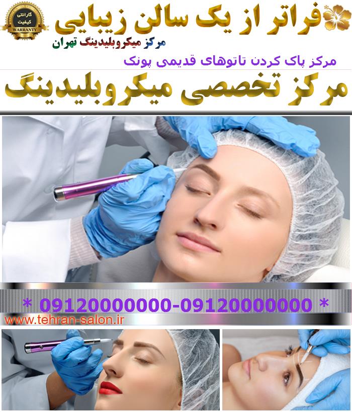 مرکز پاک کردن تاتوهای قدیمی پونک