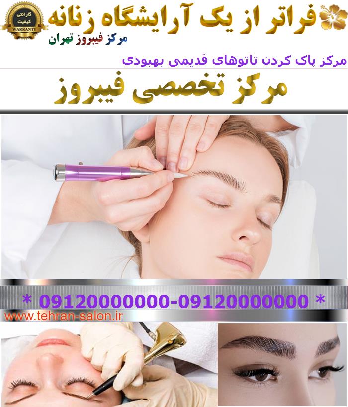 مرکز پاک کردن تاتوهای قدیمی بهبودی