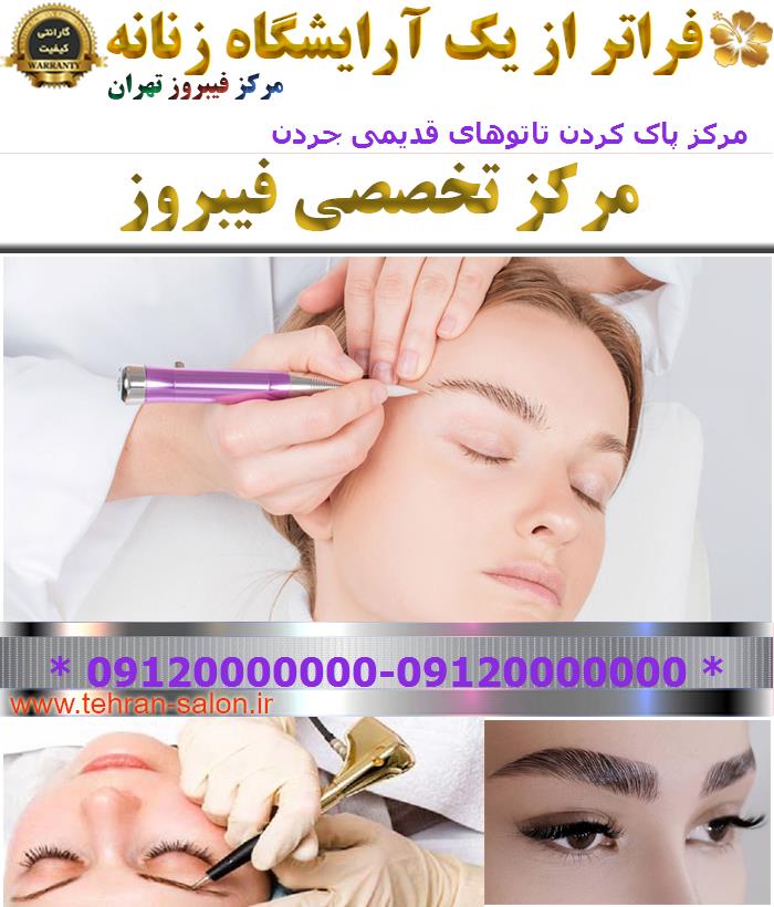 مرکز پاک کردن تاتوهای قدیمی جردن