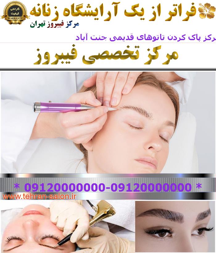 مرکز پاک کردن تاتوهای قدیمی جنت آباد