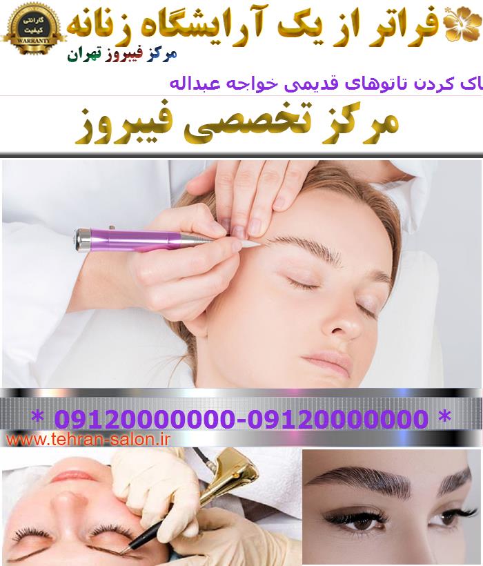 مرکز پاک کردن تاتوهای قدیمی خواجه عبداله