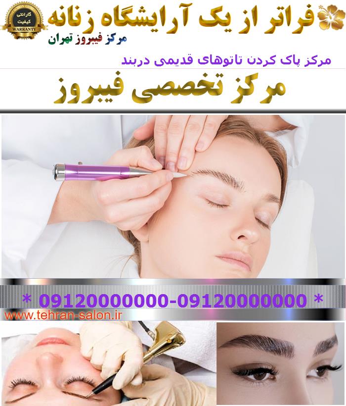 مرکز پاک کردن تاتوهای قدیمی دربند
