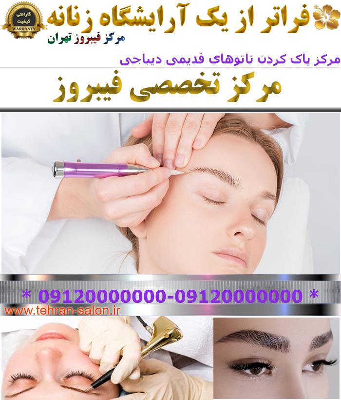 مرکز پاک کردن تاتوهای قدیمی دیباجی