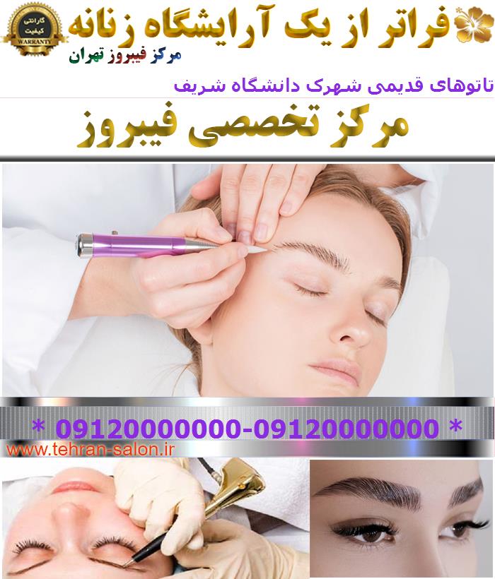 مرکز پاک کردن تاتوهای قدیمی شهرک دانشگاه شریف
