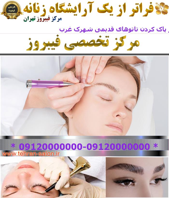 مرکز پاک کردن تاتوهای قدیمی شهرک غرب