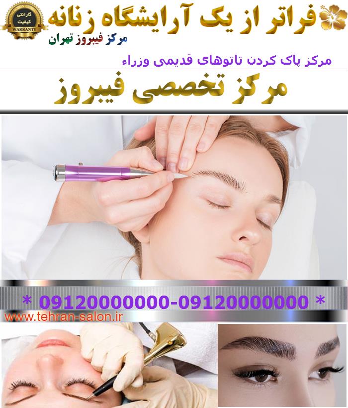 مرکز پاک کردن تاتوهای قدیمی وزراء