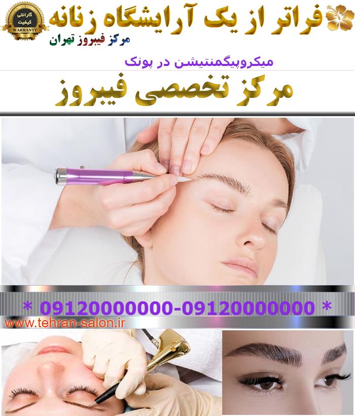 میکروپیگمنتیشن در پونک