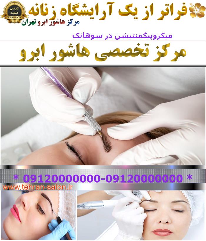 میکروپیگمنتیشن در سوهانک
