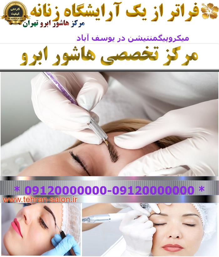 میکروپیگمنتیشن در یوسف آباد