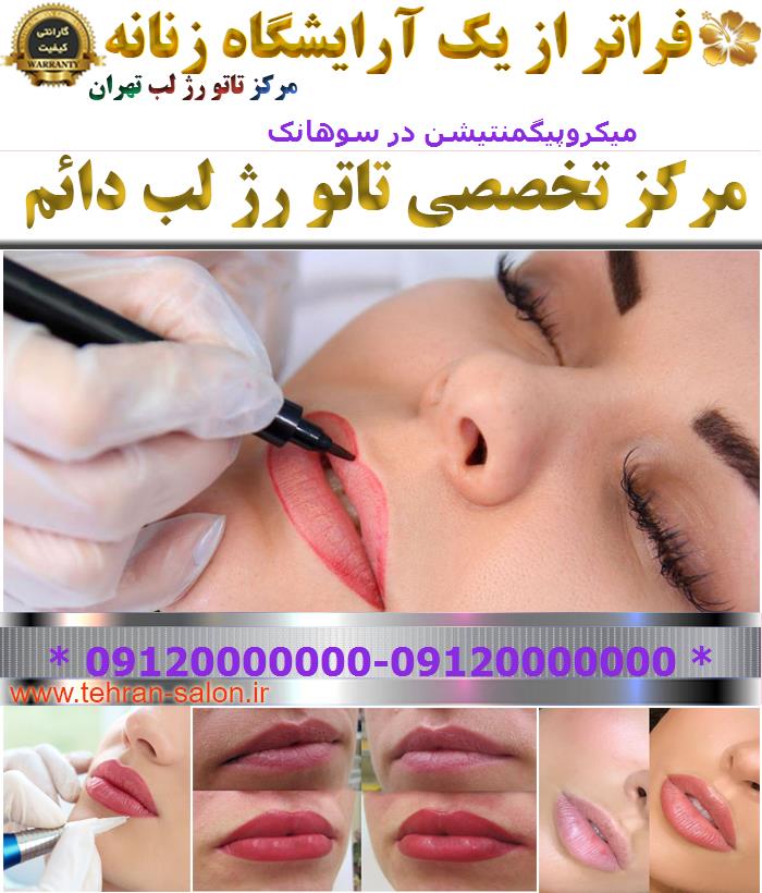 میکروپیگمنتیشن در سوهانک
