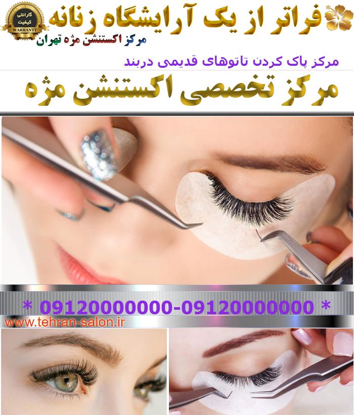 مرکز پاک کردن تاتوهای قدیمی دربند